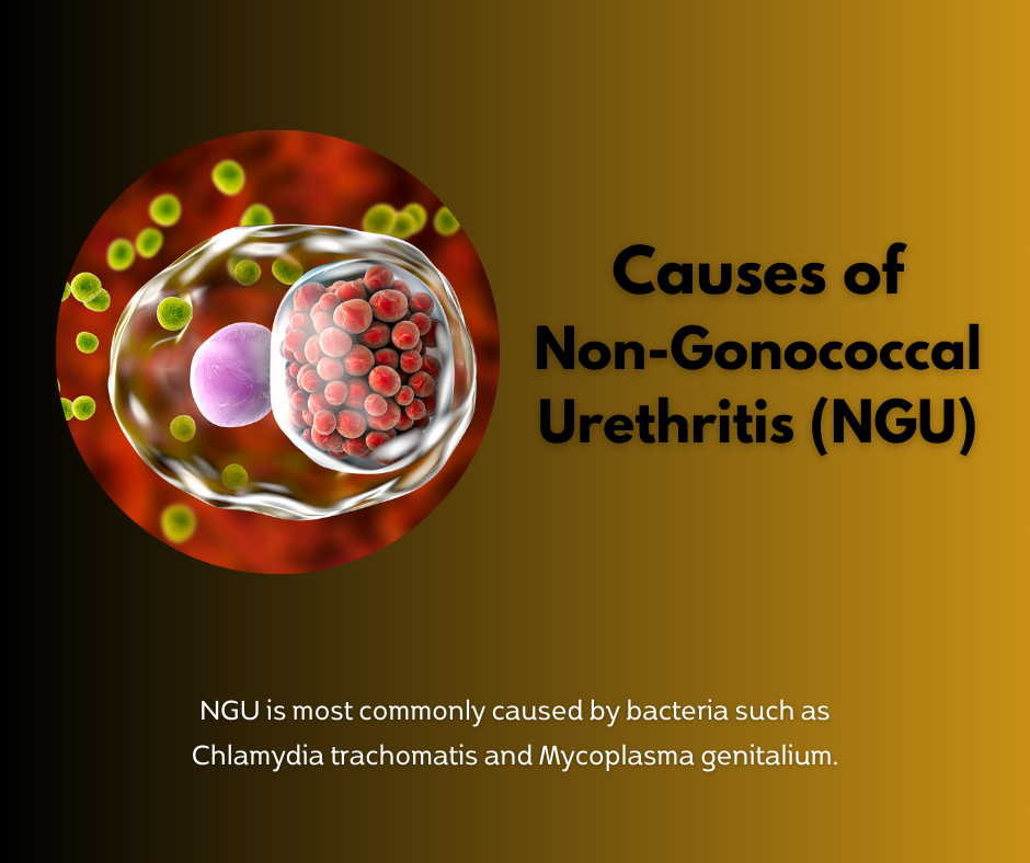 Causes of NGU