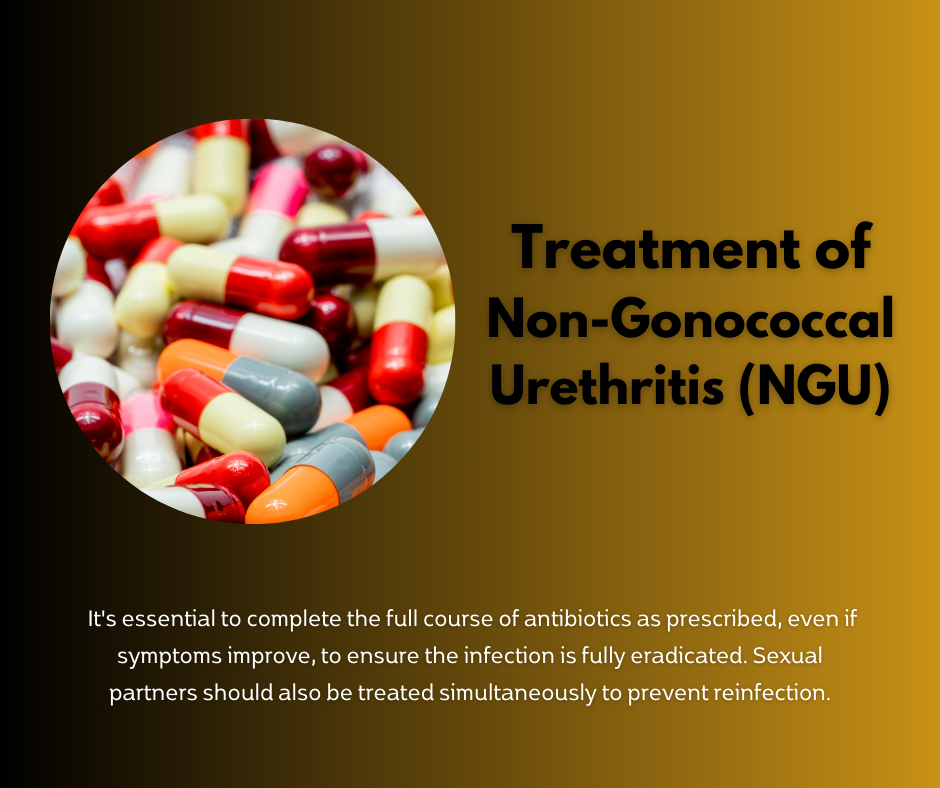 Treatment of NGU