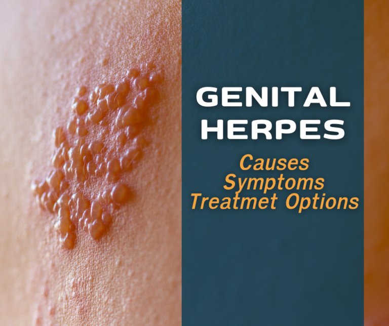 Genital Herpes Causes Symptoms and Treatment Options