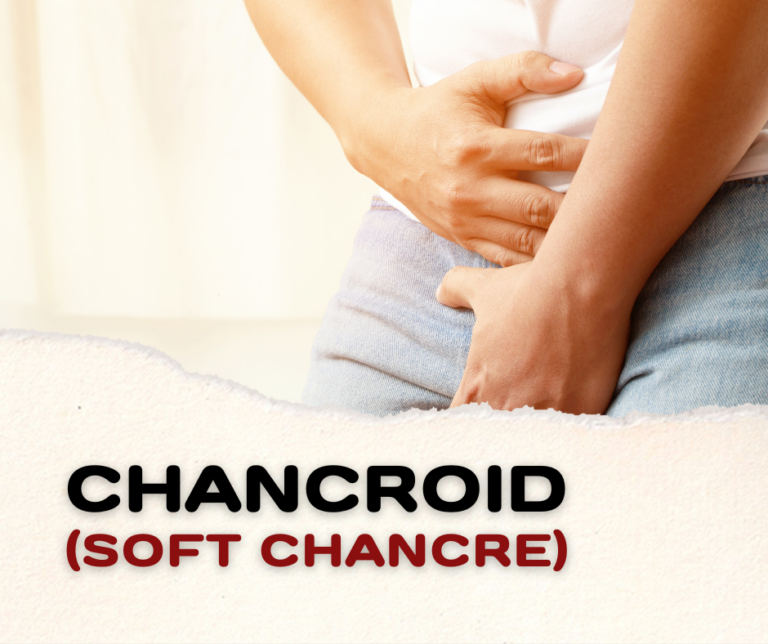 Chancroid (Soft Chancre)