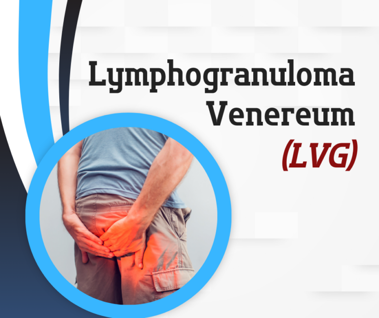 Lymphogranuloma Venereum (LGV)