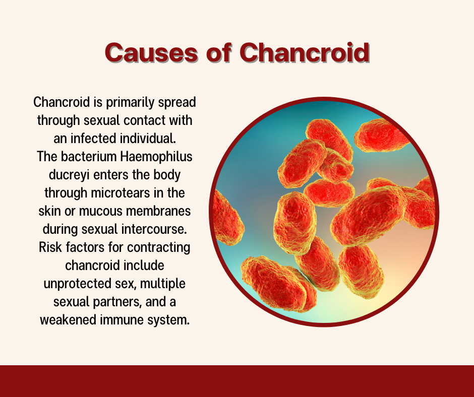 Causes of Chancroid