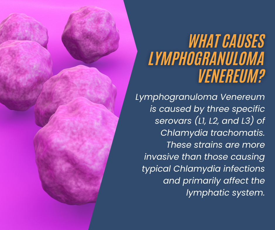 What Causes Lymphogranuloma Venereum