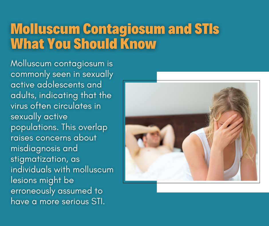 Molluscum Contagiosum and STIs What You Should Know